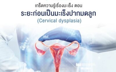 ระยะก่อนเป็นมะเร็งปากมดลูก (Cervical dysplasia) 1